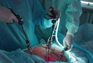 Hernia Surgery at Care & Cure by Dr. Rakesh Dhupia Best Laproscopic in Indore