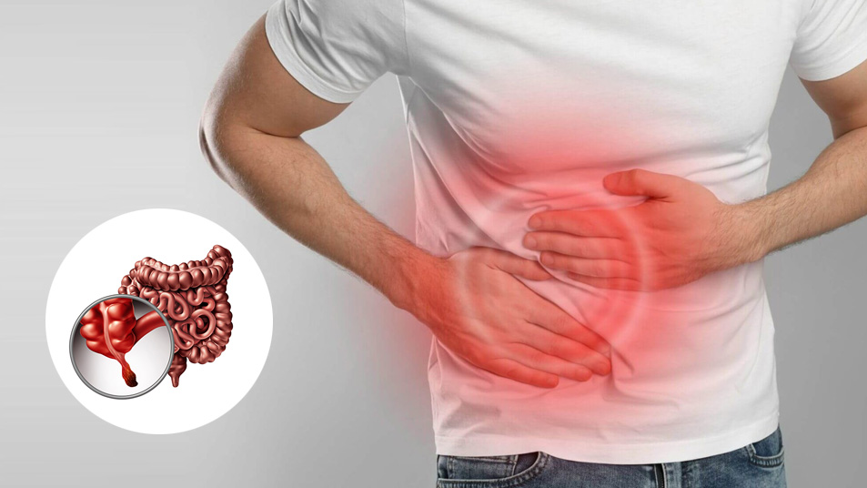 Appendicectomy: What You Need to Know About Appendix Surgery