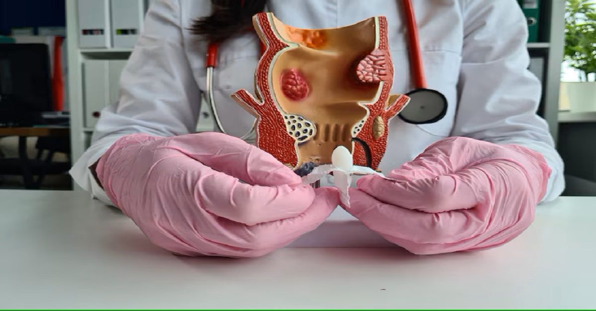 Laser vs Traditional Piles Surgery: Which Is Better for Fast Recovery?