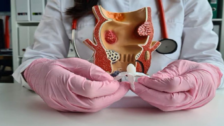 Laser vs Traditional Piles Surgery: Which Is Better for Fast Recovery?