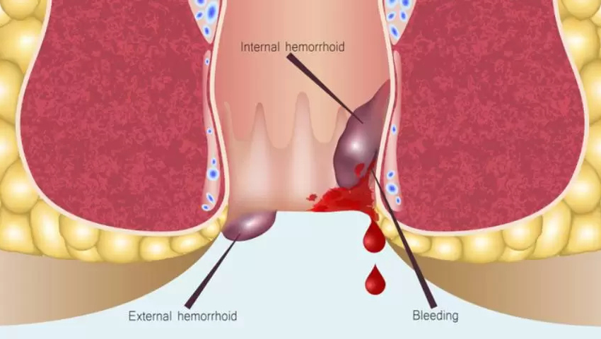 Untitled design 2026 03 30T154817.177