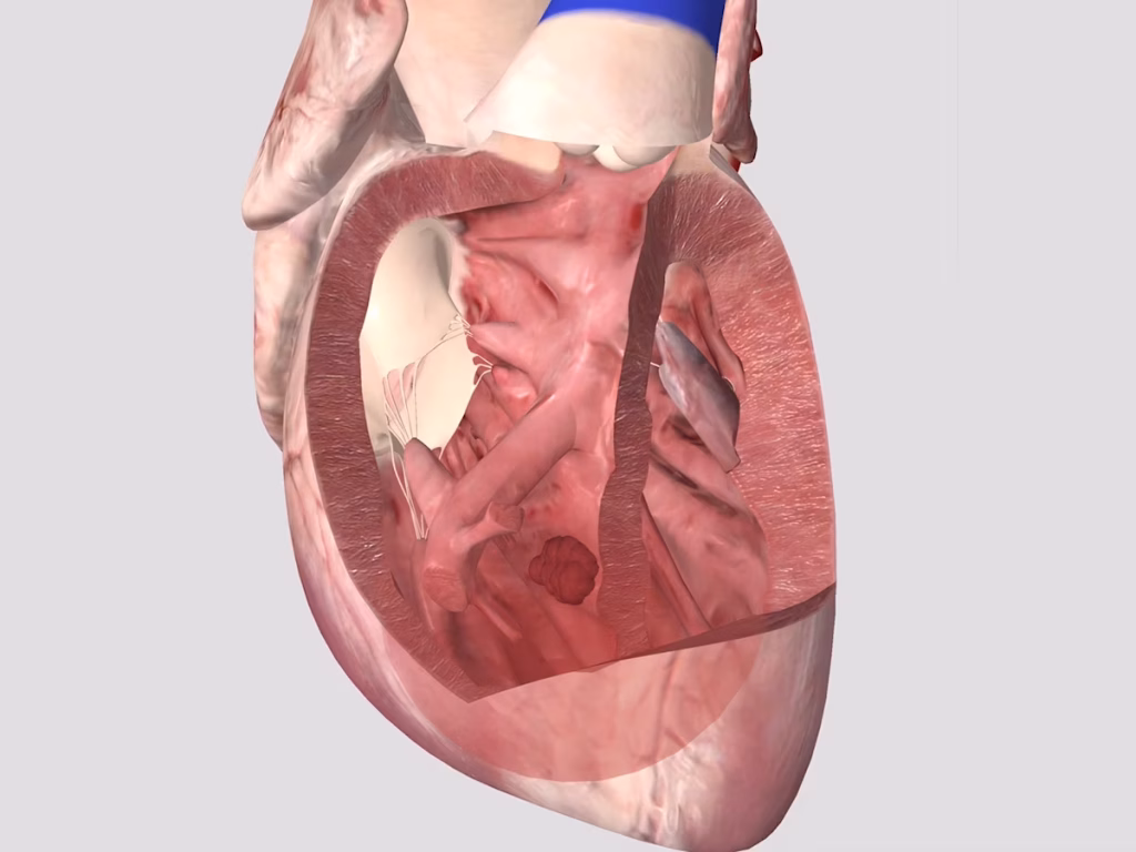 Anatomy restoring
