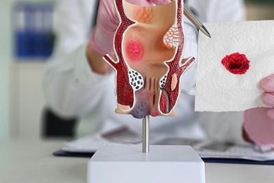 Blood supply