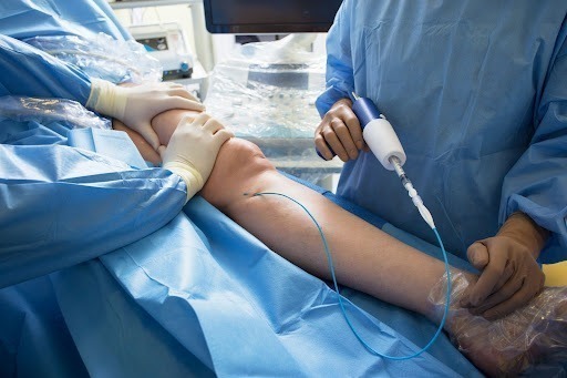 minimally invasive varicose veins surgery 1