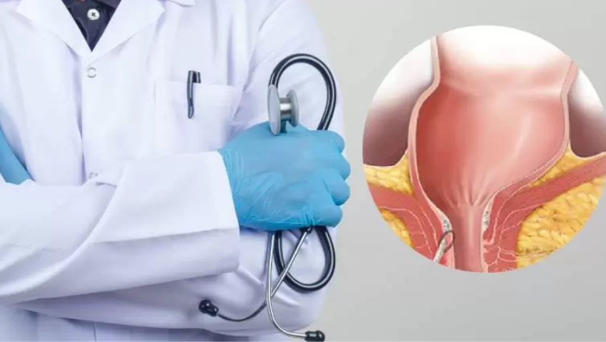 How to Choose the Right Doctor for Fistula Treatment