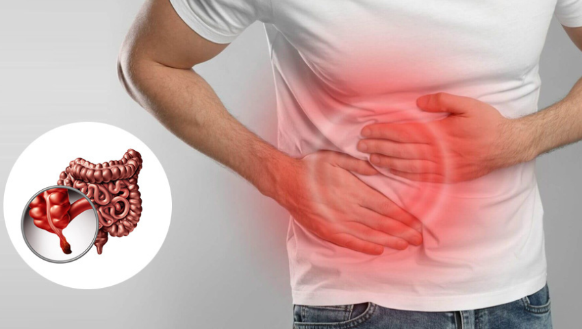 Laparoscopic vs Open Appendicectomy: Which Is Safer?