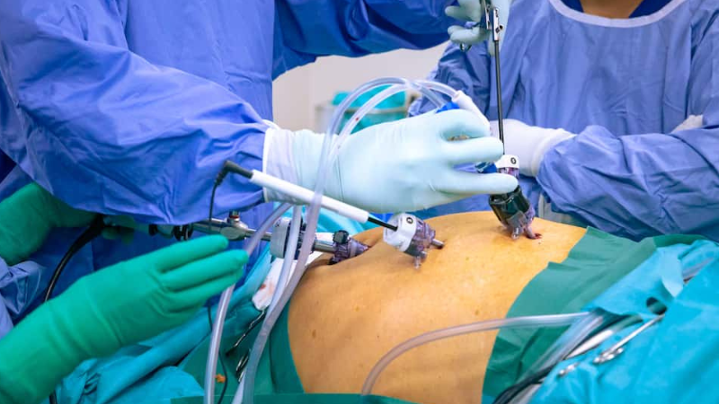 Laparoscopic Hernia Repair: What to Expect Before and After Surgery