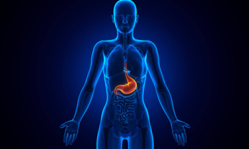 Anti Reflux Surgery at Care & Cure by Dr. Rakesh Dhupia Indore