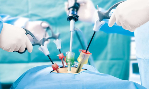 Laparoscopic Surgery at Care & Cure by Dr. Rakesh Dhupia Jain best laparoscopic surgeon in Indore